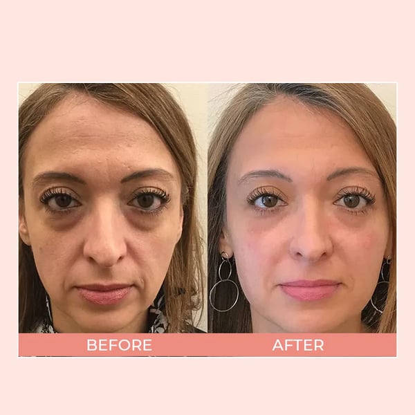 đ„LAST DAY SALE 60% OFFđ„ EIASER Retinol Polypeptide Repair Eye Cream