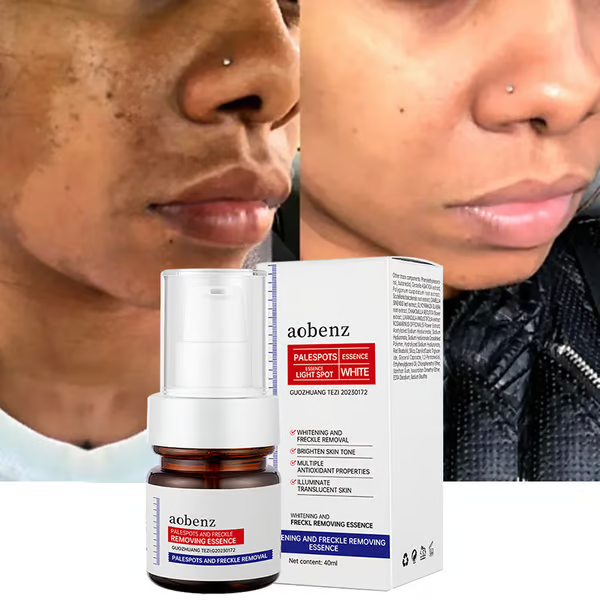 š„Vitamin C Whitening Freckles Face Cream Remove Melasma Dark Spots Lighten Melanin