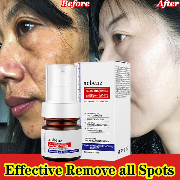 š„Vitamin C Whitening Freckles Face Cream Remove Melasma Dark Spots Lighten Melanin