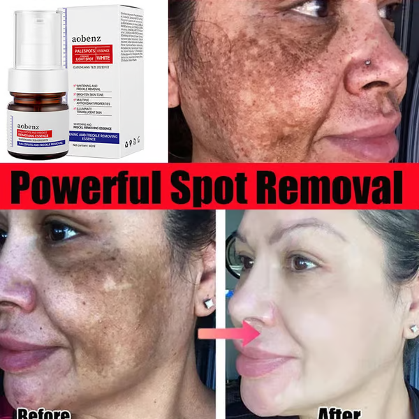 š„Vitamin C Whitening Freckles Face Cream Remove Melasma Dark Spots Lighten Melanin