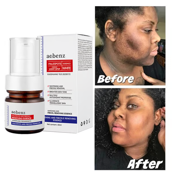 š„Vitamin C Whitening Freckles Face Cream Remove Melasma Dark Spots Lighten Melanin