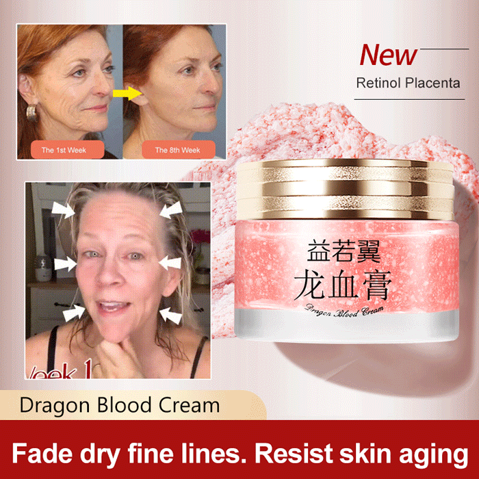 2024 NEW DRAGONS BLOOD EASY CREAM (BUY 3 GET 5 FREE)