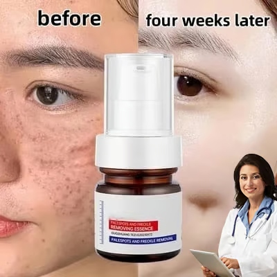 š„Vitamin C Whitening Freckles Face Cream Remove Melasma Dark Spots Lighten Melanin