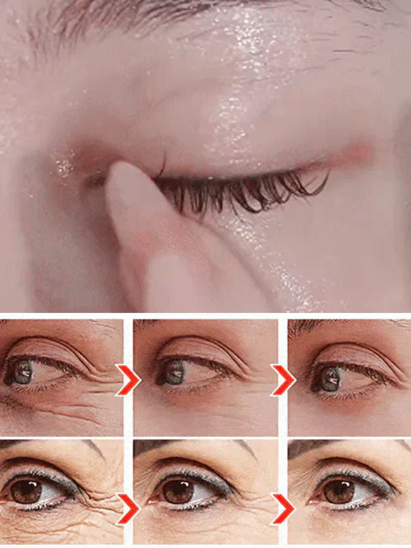 🎁BUY 1 GET 1 FREE🔥 DINKISS LUTEIN EYE ESSENCE OIL