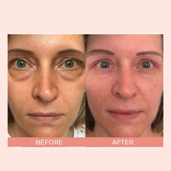 đ„LAST DAY SALE 60% OFFđ„ EIASER Retinol Polypeptide Repair Eye Cream