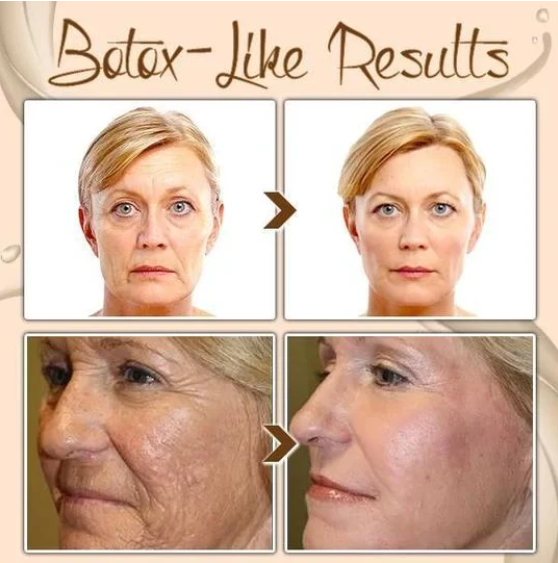 🎁2025 Hot Sale🎁Polypeptide Firming Full Face Cream-CHANGE FOR BEAUTIFUL SKIN WITHIN 2 WEEKS