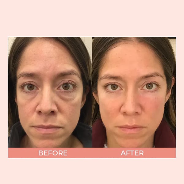 đ„LAST DAY SALE 60% OFFđ„ EIASER Retinol Polypeptide Repair Eye Cream