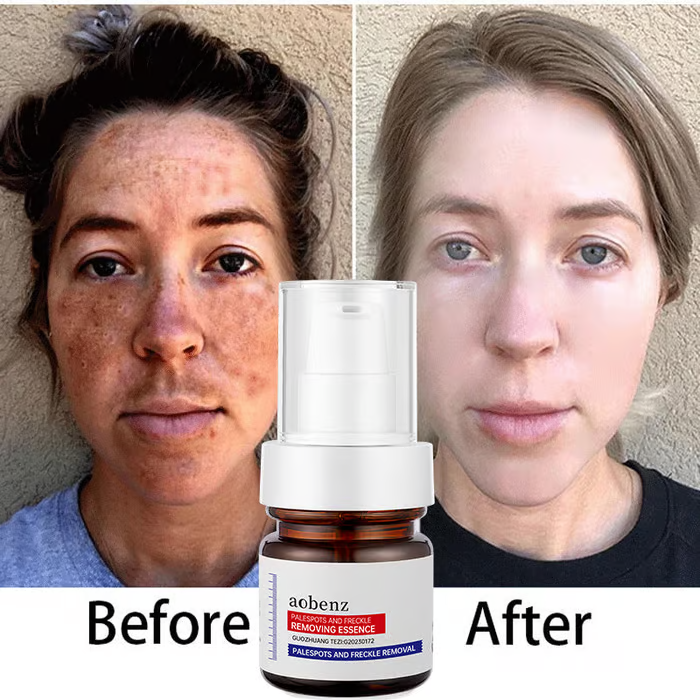 š„Vitamin C Whitening Freckles Face Cream Remove Melasma Dark Spots Lighten Melanin
