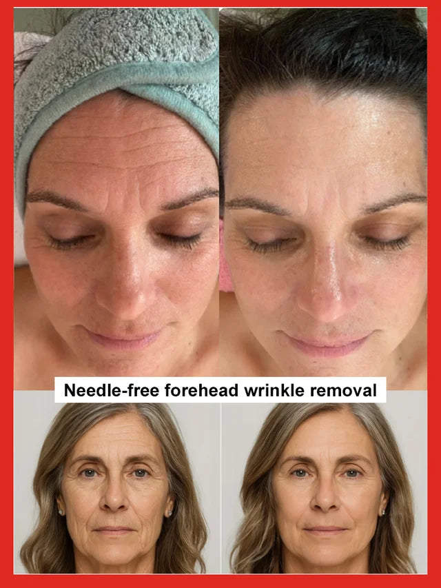 🎁BUY 1 GET 1 FREE🔥Salmon Water Light Anti-Wrinkle Essence