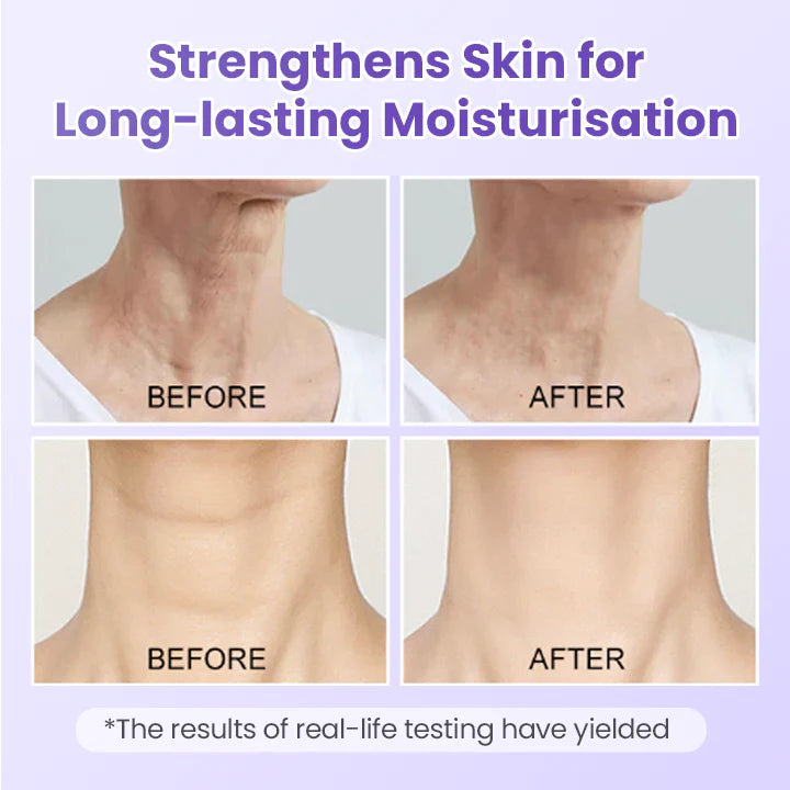 NeckYouth Peptide Anti-Wrinkle Patch