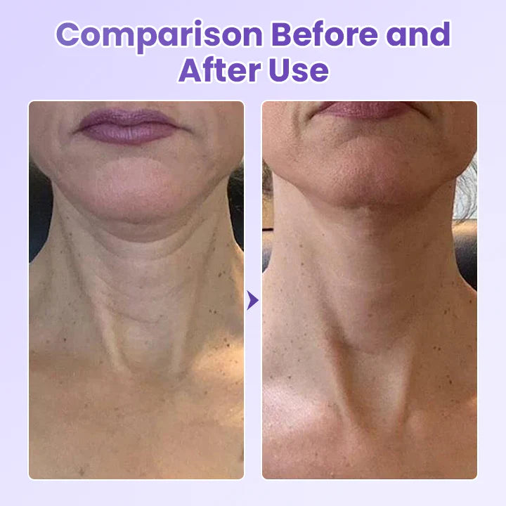 NeckYouth Peptide Anti-Wrinkle Patch